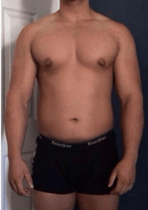 Totalna Redukcja - Przed