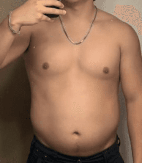 Rekompozycja - Przed